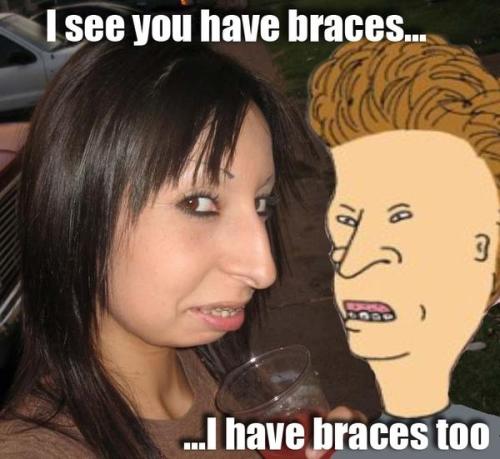Braces