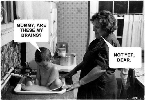 Are these my brains